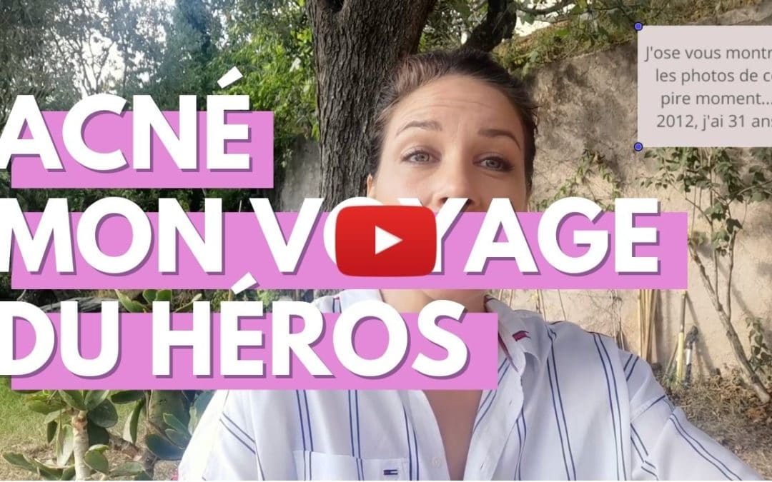 Acné hormonale, comment je l’ai vaincu grâce au naturel.